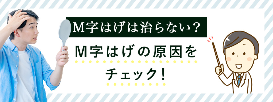 M字ハゲの原因