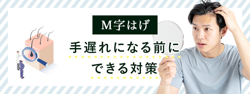 M字ハゲが手遅れになる前に