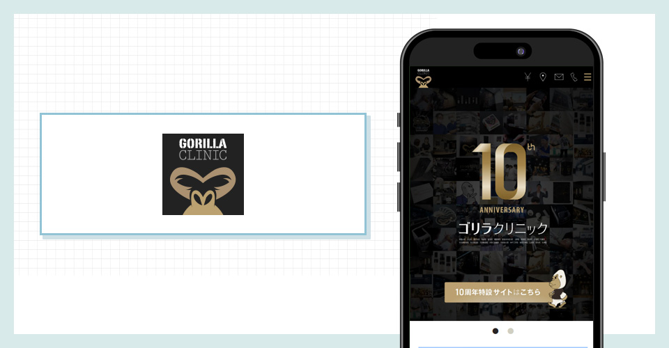 ゴリラクリニックの公式サイトを映したスマホの写真