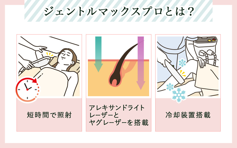 ジェントルマックスプロの特徴3つまとめ