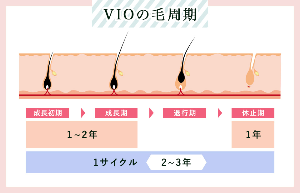 VIOの毛周期1サイクルの参考画像