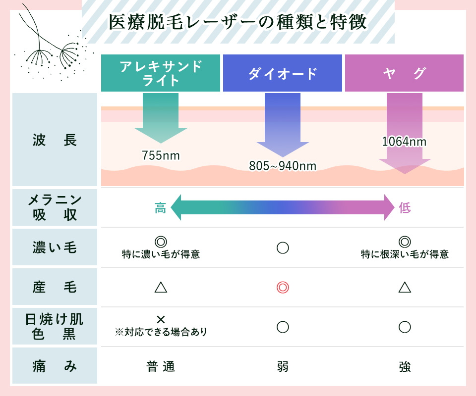 医療レーザー脱毛機の3つのレーザーの特徴まとめ