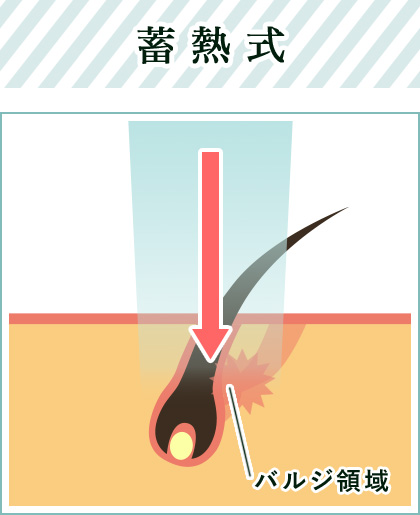 蓄熱式