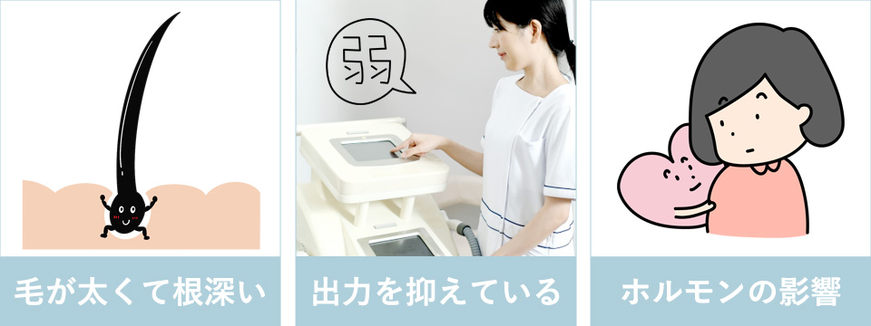 Iラインが抜けにくい3つの理由
